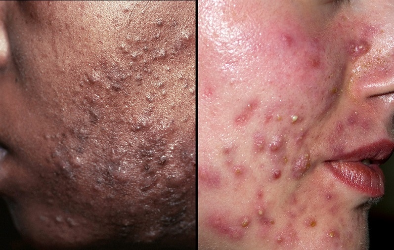 About Common Skin Conditions