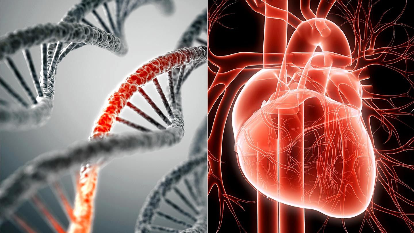 Heart Disease and Diabetes  Heart disease is typical in individuals with diabetes. Data in the National Heart Association from 2012 shows 65% of individuals with diabetes will die from some kind of cardiovascular disease or stroke. Generally, the chance of cardiovascular disease dying and stroke tend to be more than two times as full of individuals with diabetes.  While everybody with diabetes come with an elevated possibility of developing cardiovascular disease, the problem is much more common in individuals with diabetes type 2. Actually, cardiovascular disease is the main reason for dying among individuals with diabetes type 2.  The Framingham Study was among the first bits of evidence to exhibit that individuals with diabetes tend to be more susceptible to cardiovascular disease than individuals individuals who was without diabetes. The Framingham Study checked out generations of individuals, including individuals with diabetes, to try and determine the risks for developing cardiovascular disease. It demonstrated that multiple health factors -- including diabetes -- could increase the potential of developing cardiovascular disease. Apart from diabetes, other health issues connected with cardiovascular disease include high bloodstream pressure, smoking, high-cholesterol, along with a genealogy of early cardiovascular disease.  The greater health problems factors an individual has for cardiovascular disease, the greater the probabilities that they'll develop cardiovascular disease as well as die from this. Much like other people, individuals with diabetes come with an elevated chance of dying from cardiovascular disease should they have more health risks factors. However, the prospect of dying from cardiovascular disease is two to four occasions greater in you aren't diabetes. So, while you aren't one health risks factor, for example high bloodstream pressure, could have a certain possibility of dying from cardiovascular disease, you aren't diabetes has double or perhaps quadruple the chance of dying.  For instance, one medical study found that individuals with diabetes who'd not one other health risks factors for cardiovascular disease were 5 occasions more prone to die of cardiovascular disease than individuals without. Another medical study demonstrated that individuals with diabetes, regardless of quantity of other cardiovascular disease risks, were as likely to possess a cardiac arrest as someone without diabetes that has already had cardiac arrest.  Heart disease it's advocated that individuals with diabetes get their cardiovascular disease risks treated as strongly as those who have already had cardiac arrest.  What Can Cause Heart Disease in Individuals With Diabetes?  The most typical reason for cardiovascular disease in you aren't diabetes is hardening of thecoronary arterial blood vessels or coronary artery disease, that is a buildup of cholesterol within the bloodstream vessels supplying oxygen and diet towards the heart.  Once the cholesterol plaques can falter or rupture, your body attempts to repair the plaque rupture by delivering platelets to close up. Since the artery is small, the platelets could block the flow of bloodstream, not permitting oxygen delivery and cardiac arrest develops. Exactly the same process can occur in any arterial blood vessels in your body, leading to insufficient bloodstream towards the brain, creating a stroke or insufficient bloodstream towards the ft, hands, or arms causing peripheral vascular disease.  Not just are individuals with diabetes at greater risk for cardiovascular disease, they are also at greater risk for heart failure, a significant medical problem where the heart is not able to function bloodstream adequately. This may lead to fluid build-in the lung area that triggers breathlessness, or fluid retention in other areas of the body (particularly the legs) that triggers swelling.  What Exactly Are Some Signs and symptoms of cardiac arrest?  The signs and symptoms of cardiac arrest include:  Difficulty breathing.  Feeling faint.  Feeling dizzy.  Excessive and inexplicable sweating.  Discomfort within the shoulders, jaw, and left arm.  Chest discomfort or pressure (especially during activity).  Nausea.  Remember not everybody has discomfort which other classic signs and symptoms with cardiac arrest. This is also true for ladies.  *If you're experiencing these signs and symptoms, you need to call your physician, call 911, or visit the nearest er immediately.  Peripheral vascular disease has got the following signs and symptoms:  Cramping inside your legs while walking (intermittent claudication) or sides or bottom discomfort  Cold ft.  Decreased or absent pulses within the ft or legs.  Lack of fat underneath the skin from the lower areas of the legs.  Hair loss around the lower areas of the legs.  How's Heart Disease Treated in Individuals With Diabetes?  There are many treatments for cardiovascular disease in individuals with diabetes, with respect to the harshness of the center disease, including:  Aspirin therapy* to lessen the potential risks of clots that cause cardiac arrest and strokes.  Diet.  Exercise not just to lose weight, but to enhance bloodstream sugar levels, high bloodstream pressure, levels of cholesterol and also to decrease belly fat, a danger factor of cardiovascular disease.  Medicines.  Surgery.  How's Peripheral Vascular Disease Treated?  Peripheral vascular disease is treated by:  Participation inside a regular walking program (forty-five minutes each day, adopted by rest)  Special footwear  Targeting an A1c below 7%  Cutting your bloodstream pressure to under 130/80  Having your cholesterol to below 100  Aspirin therapy*  Medicines  Giving up smoking  Surgery (in some instances)  *Low-dose aspirin treatments are suggested for women and men with types one or two diabetes who're over 40 years old and areat high-risk for cardiovascular disease and peripheral vascular disease. Speak to your physician to find out if aspirin therapy fits your needs. For those who have certain health conditions, aspirin therapy might not be suggested.  Just How Can Heart Disease Be Avoided in you aren't Diabetes?  The easiest method to prevent cardiovascular disease would be to take good proper care of your and yourself diabetes.  Keep the bloodstream sugar normally as you possibly can.  Take control of your bloodstream pressure, with medication if required. The prospective for those who have diabetes is under 130/80.  Get the cholesterol figures in check. You may want to take medication to get this done.  Slim down if you're obese.  Ask your physician should you take an aspirin each day.  Get some exercise regularly.  Consume a heart-nutritious diet like the Mediterranean diet or DASH diet.  Stop smoking.  Try to reduce daily stress.