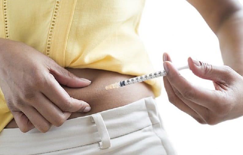 New Procedure Could Eliminate the requirement for Insulin for many with Diabetes Type 2