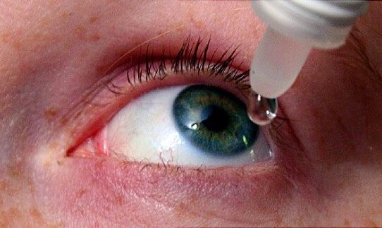 Eyes Constantly Dry