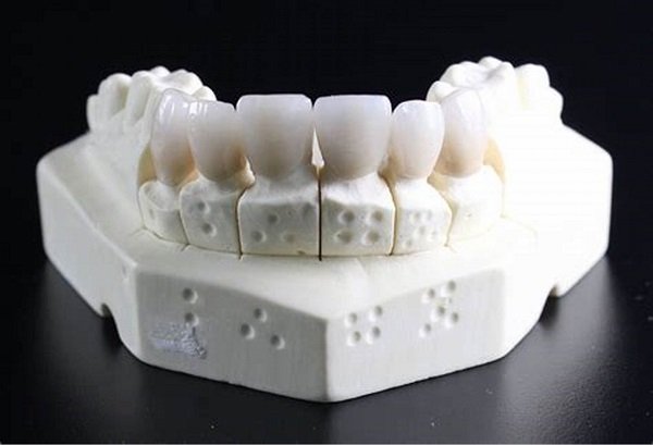 Learning about the new dental crown option – Zirconia!