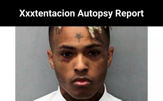 Xxxtentacion Autopsy Report